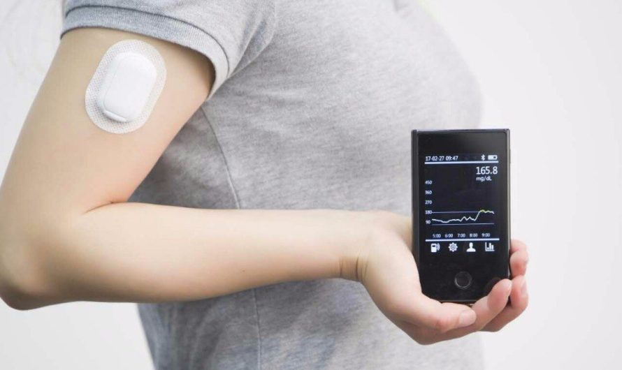 China Continuous Glucose Monitoring Devices Market: Promising Growth Fueled by Technological Advancements
