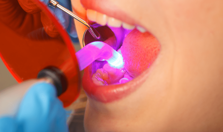 Dental Polymerization Lamps Market: Growing Demand for Efficient Curing Technology
