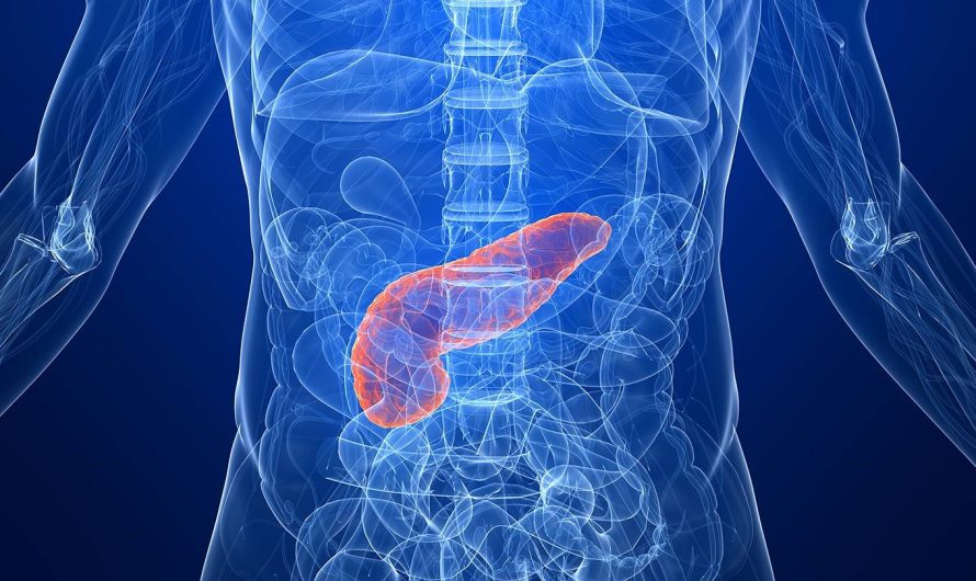 The Global Pancreatic Cancer Therapeutics and Diagnostic Market Is Estimated To Witness High Growth Owing To Increasing Incidence of Pancreatic Cancer and Rising Demand for Advanced Diagnostic Technologies