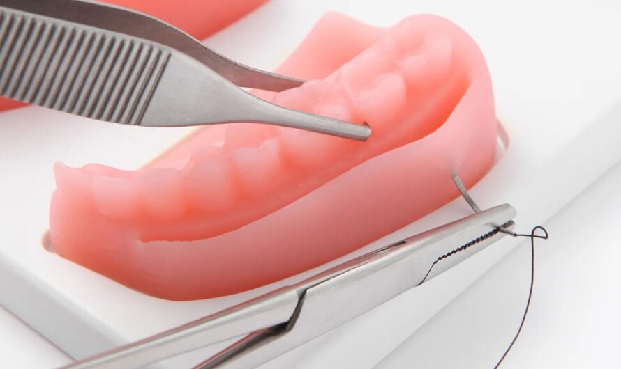 The Dental Suture Market Poised to Witness Significant Growth