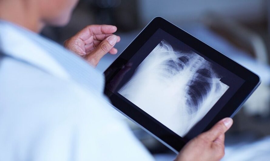 Digital Mobile X Ray Devices Market is Expected to be Flourished by Growth in Remote Diagnosis and Telehealth Services