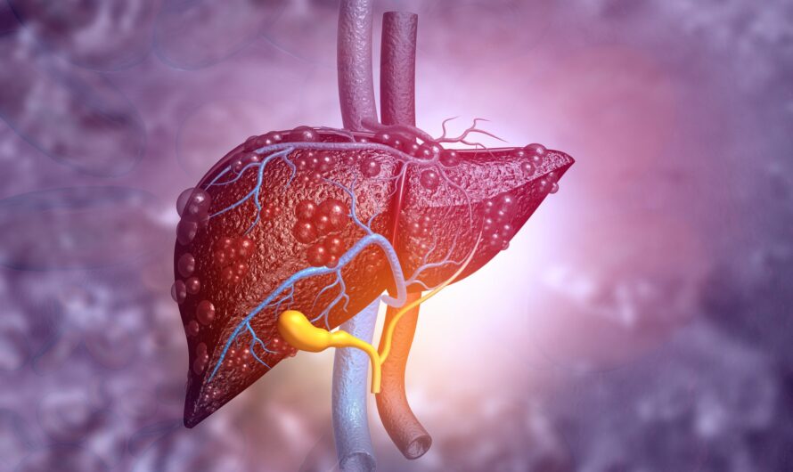 Liver Fibrosis Treatment Is Estimated To Witness High Growth Owing To Growing Prevalence Of Liver Diseases