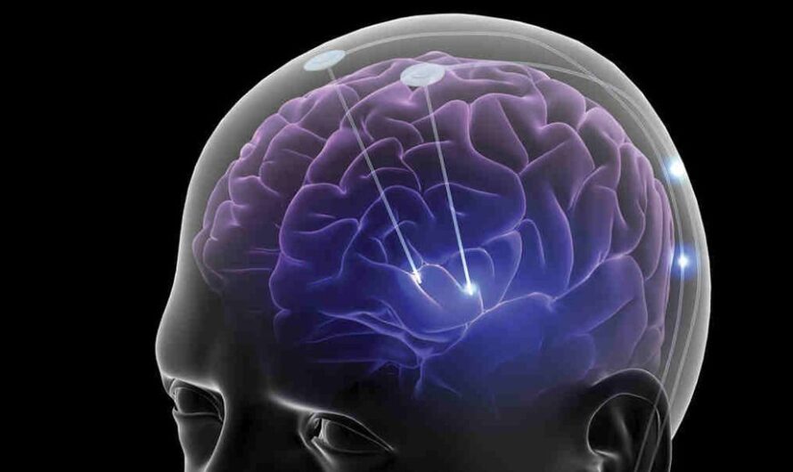 New Pathway Discovered to Prevent Cognitive Decline after Radiation Treatment