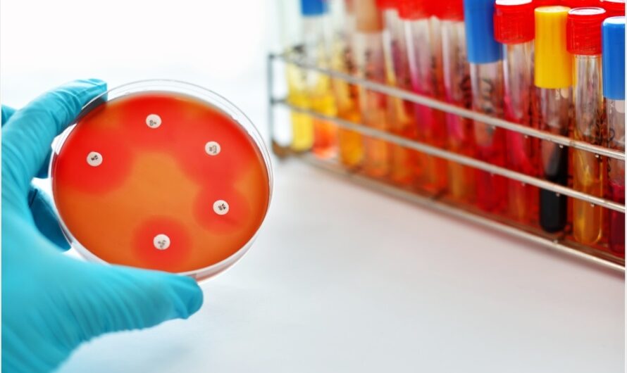 Antimicrobial Susceptibility Testing Market is Expected to be Flourished by Increasing Cases of Hospital-Acquired Infections