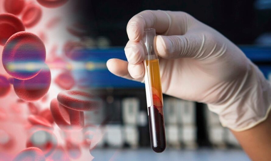 Human Platelet Lysate Market Is Expected To Be Flourished