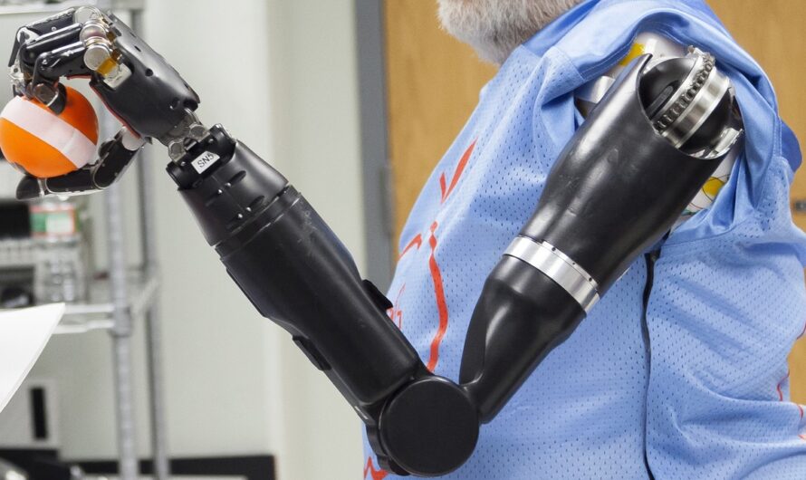 Advancement In Bionic Technology Anticipated To Open up The New Avenue For Global Robotic Prosthetics Market