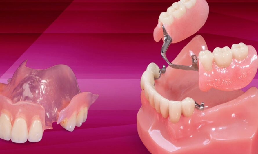Prosthetic Full Arch Dentures: Restoring Oral Health and Confidence