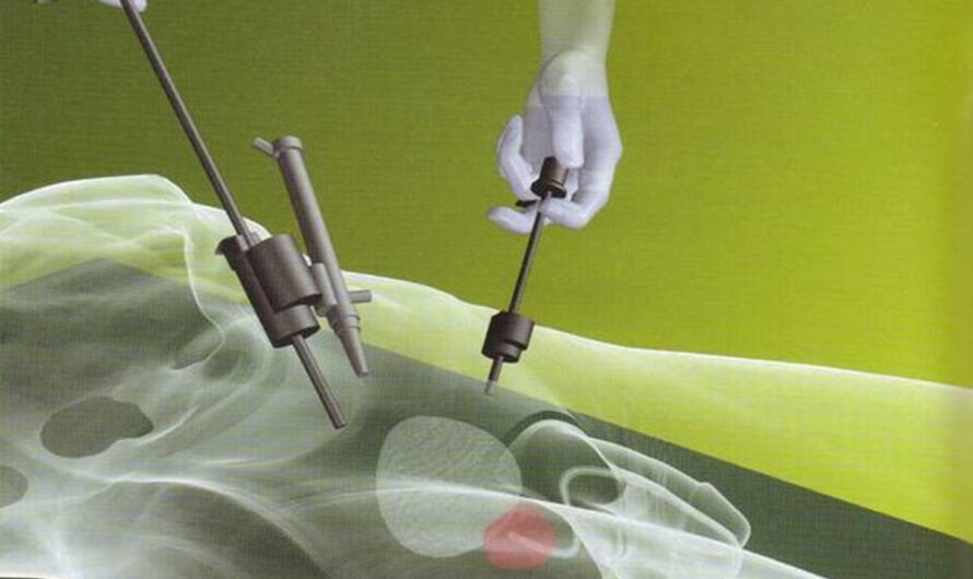 Laparoscopic Electrodes Industry: Global Laparoscopic Electrodes Market: Latest Trends, Growth Drivers, and Future Prospects