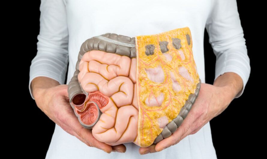 New Study Reveals Specific Gut Bacteria Associated with Inflammatory Bowel Disease
